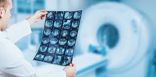 Radiografiile dentare sunt importante pentru zâmbetul tǎu